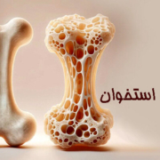 tDtAHLYw6S3o وقتی بدن ساکت می‌ماند؛ رابطه کم‌تحرکی با پوکی استخوان